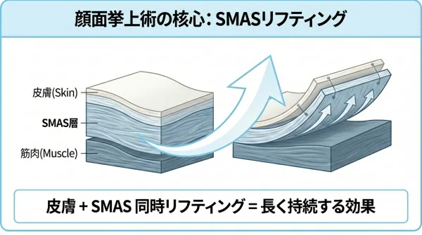 顔面リフト手術完全ガイド：整形外科専門医が教えるすべて