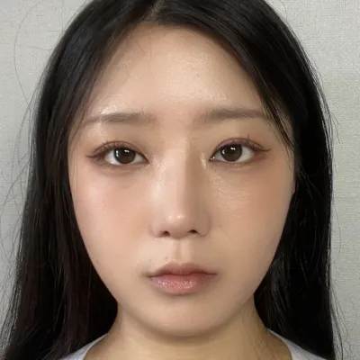 2ヶ月目になったら、目が自然にきれいになり、位置も安定したようです〜