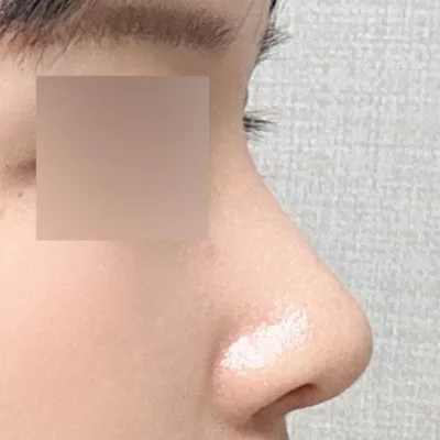 周りからもすごく良くなったと褒められます