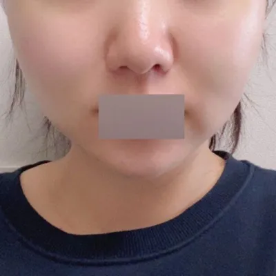 シム・ジョンファン院長先生の手つきがすごく繊細なようです