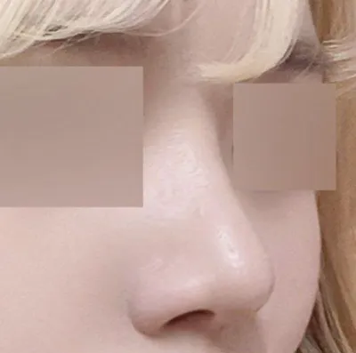 院長先生への信頼感がなければやらなかったと思います（笑）